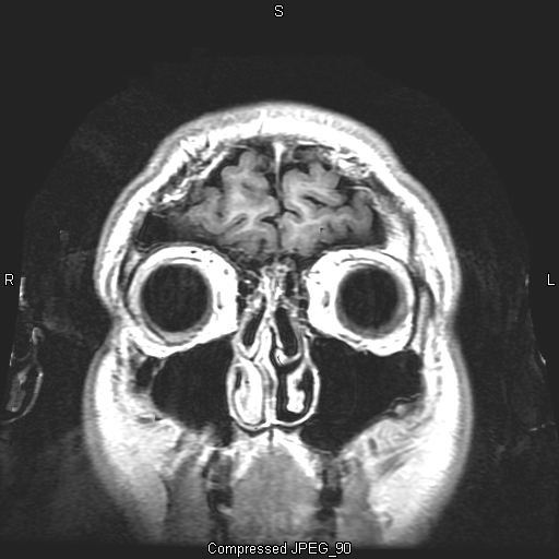 MRI Album 8 Pic 34